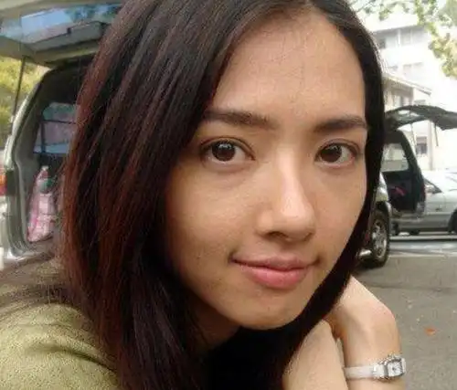 郭碧婷婚后宛如"毁容",下巴歪斜满脸油腻,简直判若两人!