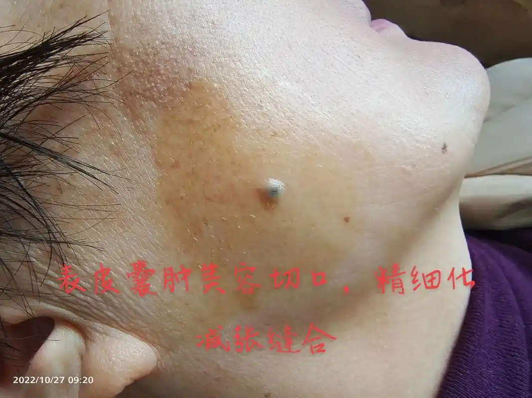 扶风县医院皮肤科