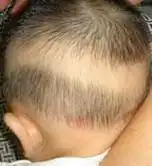 婴儿毛发发育有自己的特点.