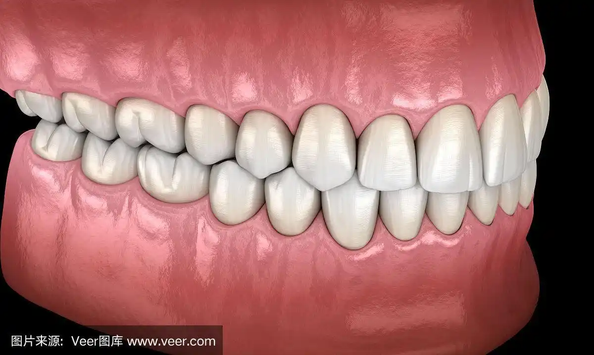 侧面图,正常咬合的健康人类牙齿.医学上准确的牙齿3d插图