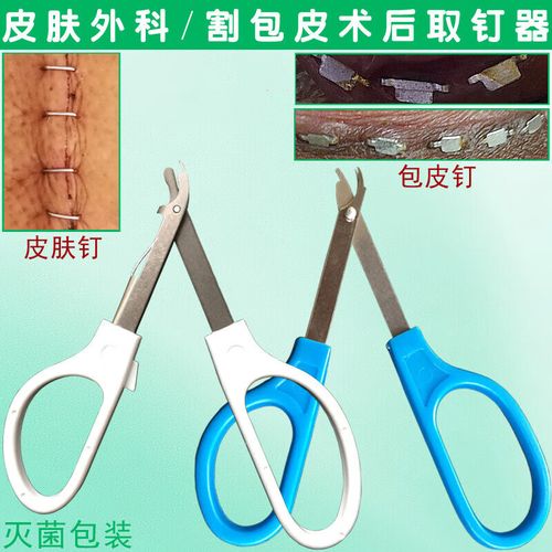拆钉器吻合器皮肤缝合起钉器拔钉皮钉器 包皮取钉器 蓝色/割包皮手术