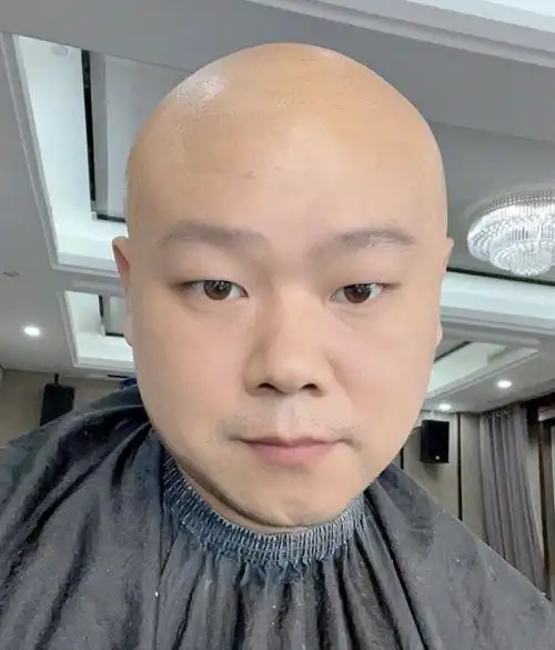 岳云鹏发光头照,师弟朱鹤松借机调侃,网友评论更搞笑_腾讯新闻