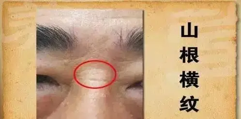 鼻梁有横纹的情况比较少出现在年轻人身上,那么如果鼻梁出现横纹代表