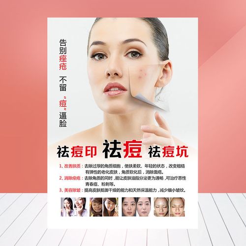 专业祛斑祛痘广告海报祛痘印痘坑宣传中药美容护肤面膜贴画1797