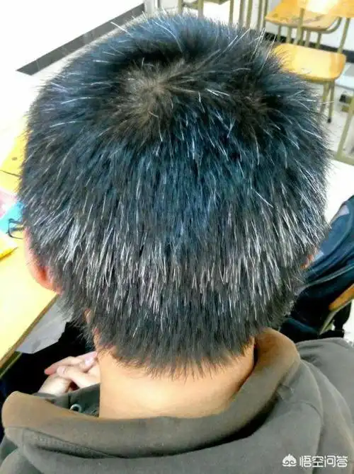 身体缺什么营养会长白头发