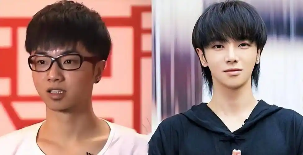 整过容的6位男星:削骨,打针,垫鼻梁样样不手软,天然脸不好吗_陈晓东