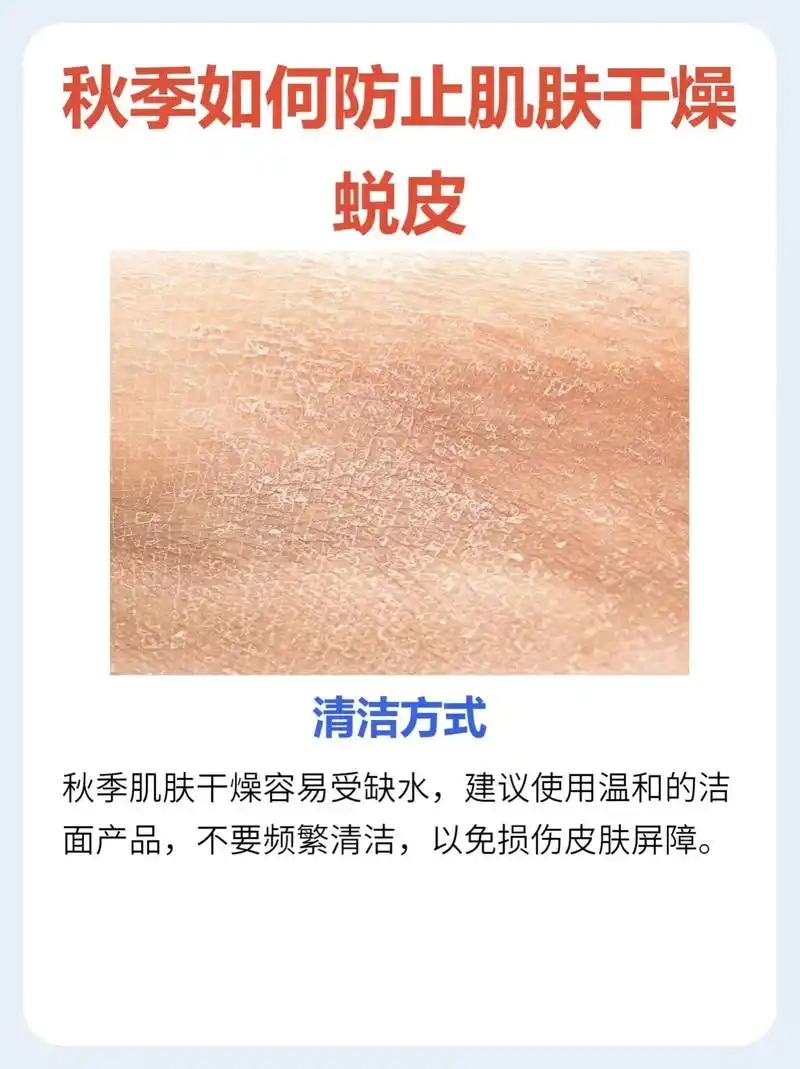 皮肤蜕皮干燥该怎么办?#干燥起皮 #解决任何皮肤问题 #轻松 - 抖音