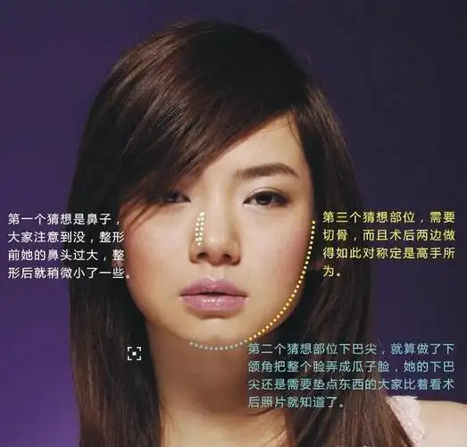 我是杜拉拉热播引骂战 戚薇自曝整容真相内幕