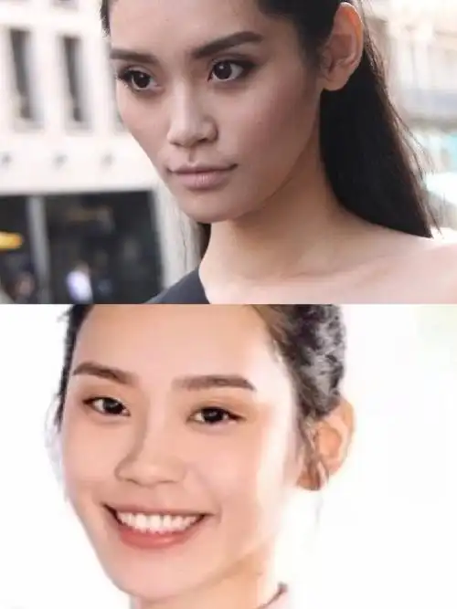 但是从近照可以看到已经成为妈妈的她状态奚梦瑶脸部填充对比奚梦瑶