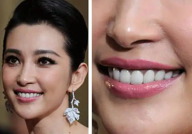 如何永肉眼识别明星们的假牙?