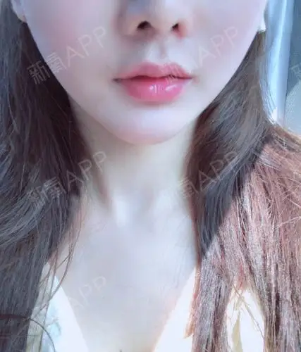 看电视一直都很羡慕别人的那种嘟嘟唇,很有特色,而且_圈子-新氧美容