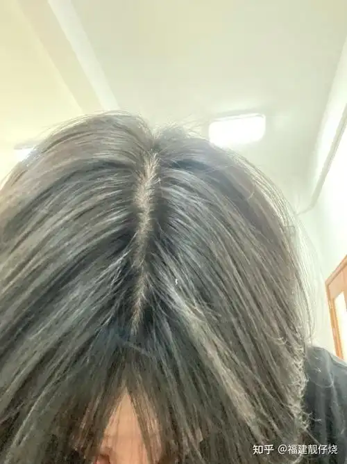 记录7年拔毛癖患者自愈日记 - 知乎