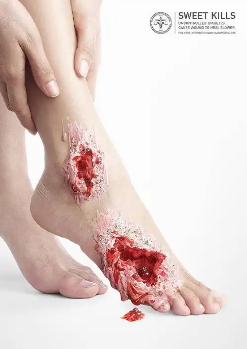 却是草莓奶油蛋糕的杰作 感受在从骨头里面腐烂 ▼