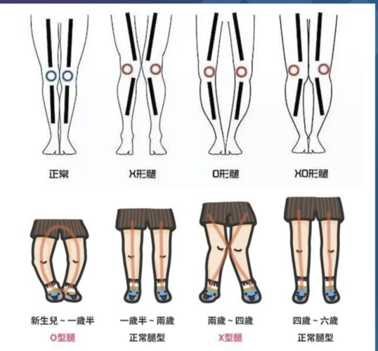 「女明星腿精大赏」o型腿是如何蜕变成美腿的?