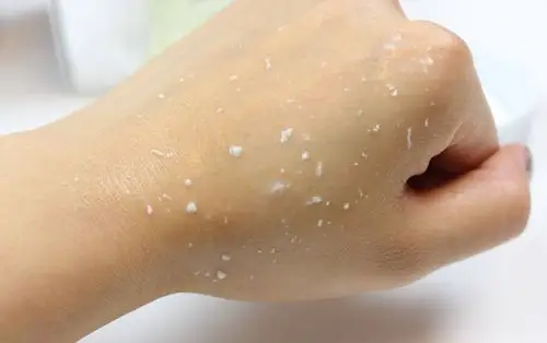 大多数女人不知道,补水前还有一个步骤,做好这件事护肤效果翻倍_角质