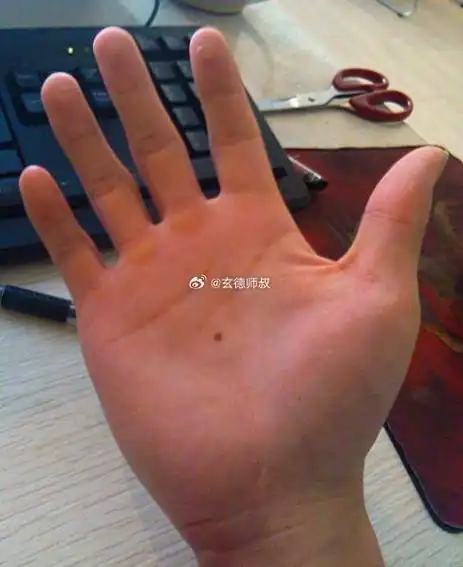 "你掌心的痣,我总记得在哪里"从相学角度来说,手掌心有痣的男人,属于