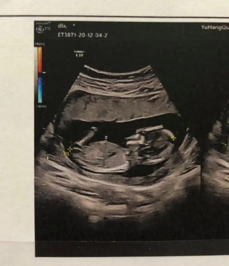 猜猜男女 娱乐一下 下个月给大家开奖!