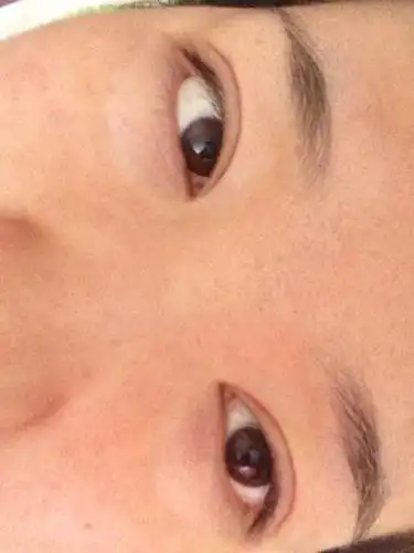 最近下眼皮发白怎么回事啊