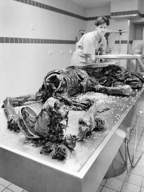 揭秘真实法医解剖室!胆小勿入(组图)