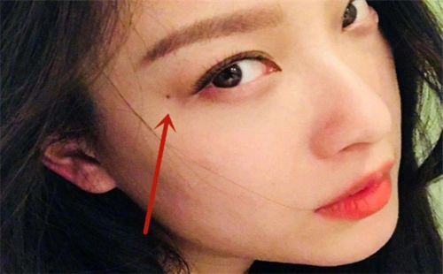 泪痣的位置有多个你不一定都知道