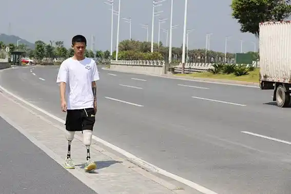 关于长残肢小腿假肢装配的小贴士_绷带_锻炼_膝关节