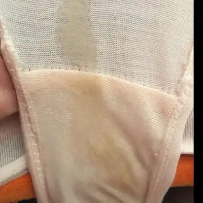 怀孕初期白带会多吗?