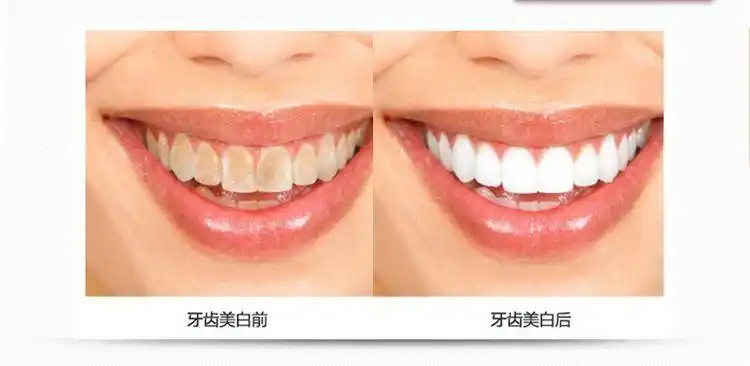 知道原因才好预防那么牙齿黄的原因到底有哪些