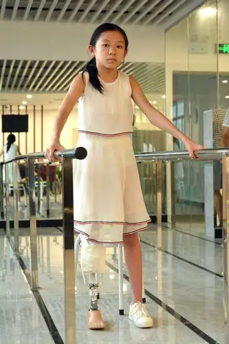 第九步:假肢患者训练行走.