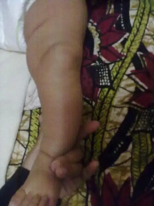 需要矫正吗?从出生到现在4个半月了,没有改善