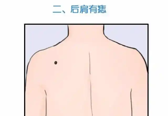 四个绝佳的财富痣,占一颗,够你一辈子大富大贵_一生_事业_运和