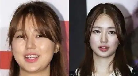 鱼子酱爱那个总结下来就是看头上围,下巴和鼻子,来判断你是不是个瘦