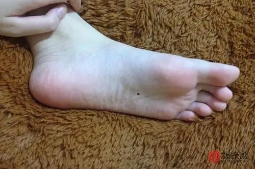 脚板下长痣好不好