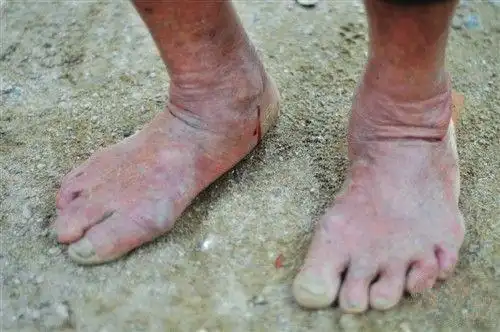 看看孟奶奶的双脚,由于常年劳作和终日奔波,长满了老茧,身体更是不堪