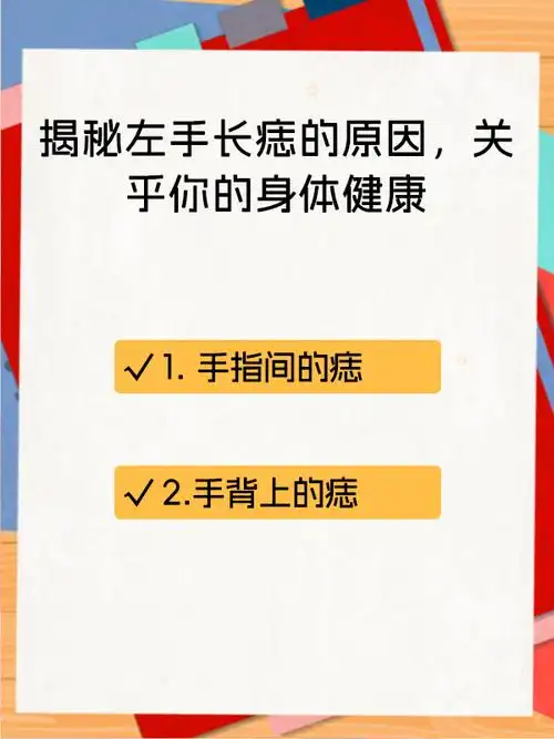 揭秘左手长痣的原因,关乎你的身体健康