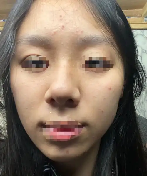 皮肤这样算正常的吗