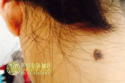 你知道苦情痣有什么说法吗