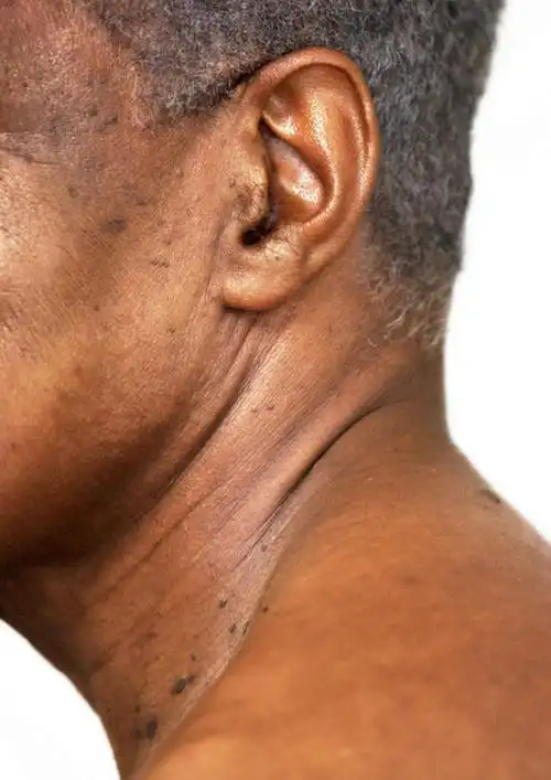 西方人,耳朵,脑,一个人,站,竖图,室内,特写,白天,白色背景,侧面,欧洲