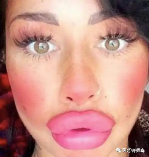 有什么关于嘴巴的整容项目吗