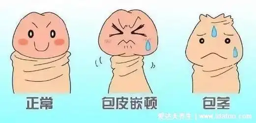 包茎手术20天恢复图片