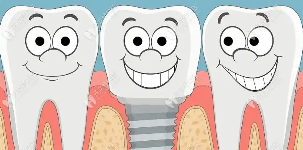 这是种植牙卡通图