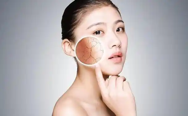 补水是所有护肤的基础,春季若不注重补水,皮肤就会越来越干,出现脱皮