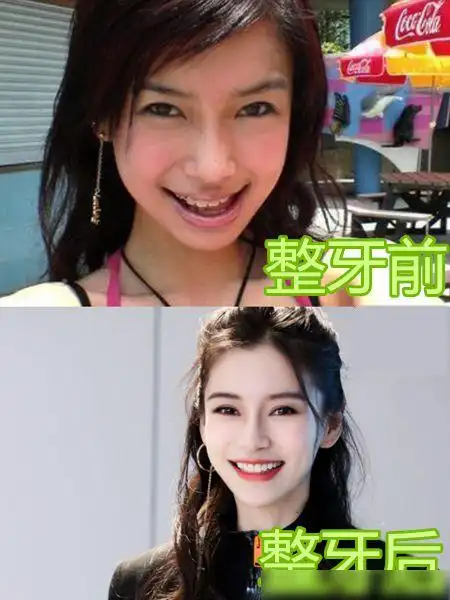 明星整牙前后差距有多狠杨颖变靓丽蔡徐坤变精致看到胡歌幸好整了