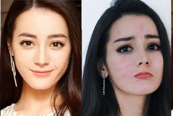 杨幂卸妆后脸全红斑烂脸照曝光粉丝全暴怒