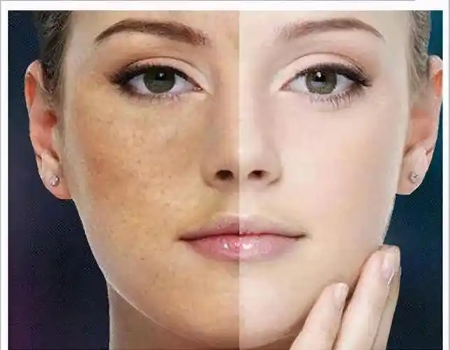 加班熬夜皮肤差?我来教大家熬夜护肤小技巧