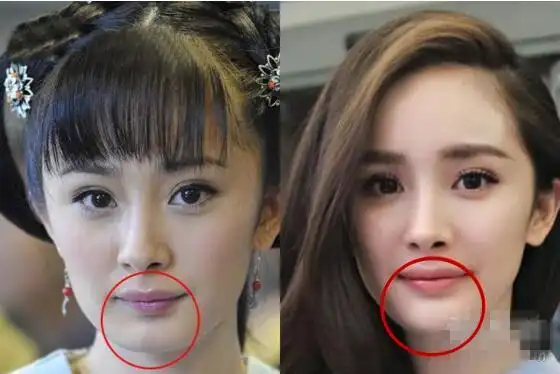 杨幂整容前和整容后杨幂整容前长什么样