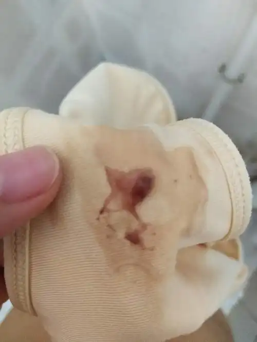 近两天发现白带增多,白带带有血色,小腹