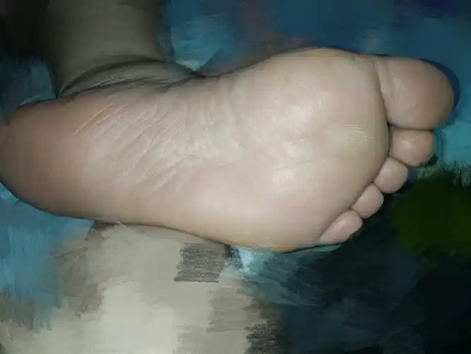 前脚掌一直是这块骨头在用力,所以好疼啊.都有了死皮了!特别疼!是否前