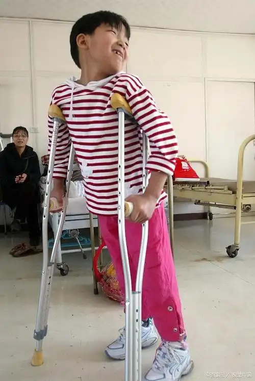 曾经的篮球女孩脱胎换骨成全国冠军如今装上假肢美若天仙