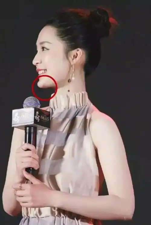 李沁下巴本来就挺翘,但看看最近的这张照片,无论如何也没有翘到这个