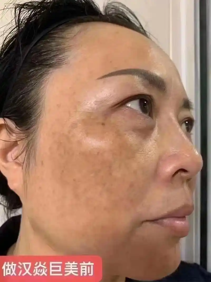 一家技术不错的店 #提亮肤色改善暗沉 #解决任何皮肤问题  - 抖音